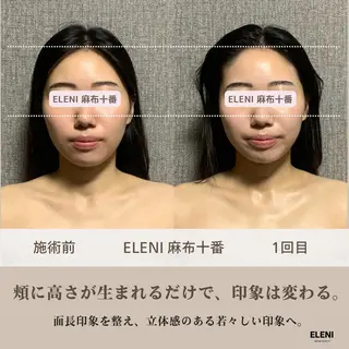 麻布十番小顔コルギ 姿勢矯正リアン💗のエステ・リラクイメージ