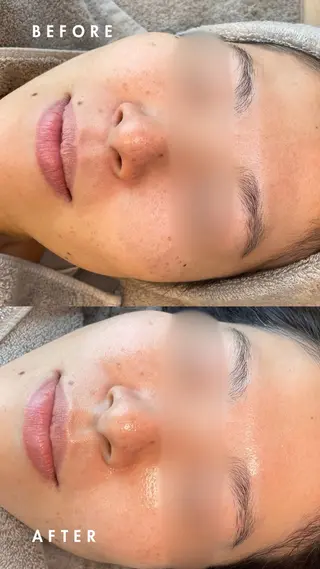 cocofleur 美容看護師監修サロンのエステ・リラクイメージ
