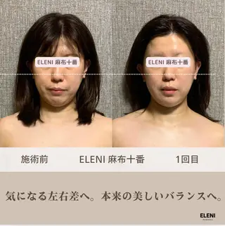 麻布十番小顔コルギ 姿勢矯正リアン💗のエステ・リラクイメージ