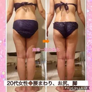 ショート カラー パーマ ヘアアレンジ メンズ キッズ ネイル マツエク・マツパ ‍痩身＆ボディ 結果出し🌟丹野のエステ・リラクイメージ
