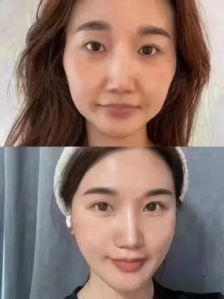 ネイル 愛維美水光専門店 川崎彩鳳のエステ・リラクイメージ