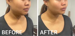 大阪脱毛|ちぇるま| 眉毛Wax｜美肌管理のエステ・リラクイメージ