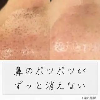 ニキビ経験者が施術 する専門サロン🌻のエステ・リラクイメージ