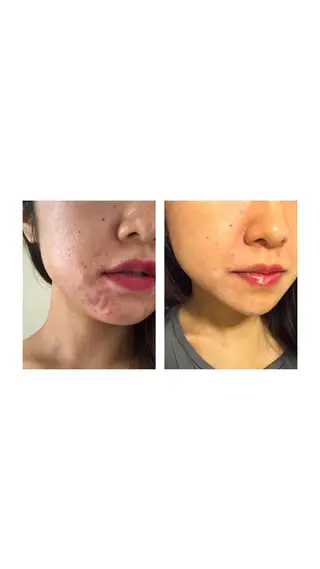 肩首こり×痩身×浄化 🌿リンパエステのエステ・リラクイメージ