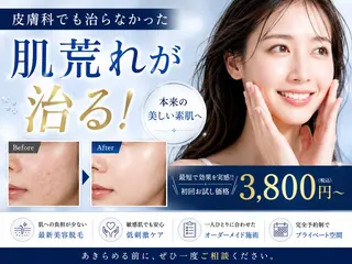 脱毛サロン ファインアートのエステ・リラクイメージ