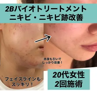 カシェット トーキョーのエステ・リラクイメージ