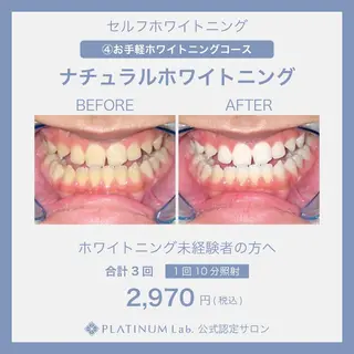 プラチナム ビューティー川口店のその他イメージ