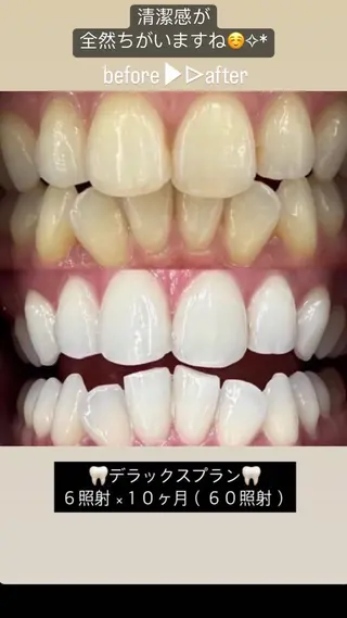 ラブホワイトニング 池袋店 ヒカルのエステ・リラクイメージ