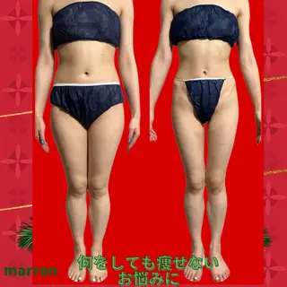 痩身ハイパーナイフ ララピールリアボーテのエステ・リラクイメージ