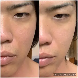 メンズ エステサロン LilyRoseのエステ・リラクイメージ