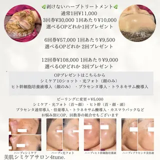 美肌シミケアサロン 4tune.RUMIのその他イメージ