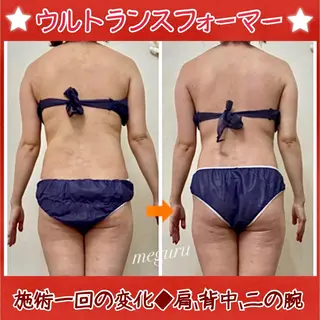 ショート カラー パーマ ヘアアレンジ メンズ キッズ ネイル マツエク・マツパ 痩身&ボディ 結果出し🌟丹野のエステ・リラクイメージ