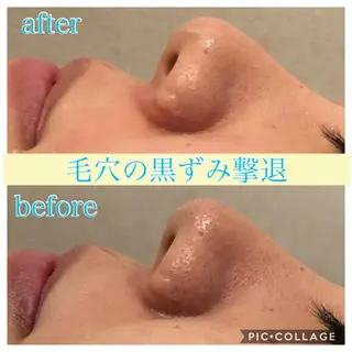 ロング カラー パーマ ヘアアレンジ キッズ ネイル マツエク・マツパ EnsorClair 代表 野口真央のエステ・リラクイメージ