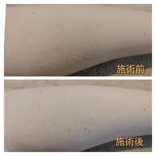 viage 脱毛&フェイシャル店のエステ・リラクイメージ