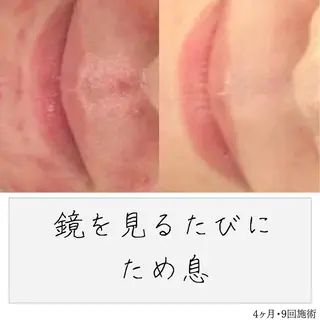 ニキビ経験者が施術 する専門サロン🌻のエステ・リラクイメージ