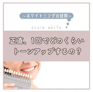 セルフホワイトニング エクシア大宮東口店のその他イメージ