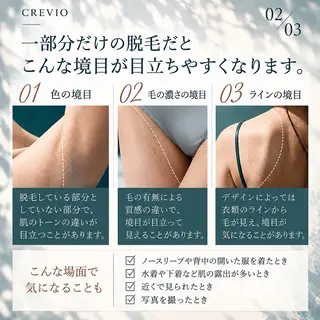 脱毛サロン CREVIOのエステ・リラクイメージ