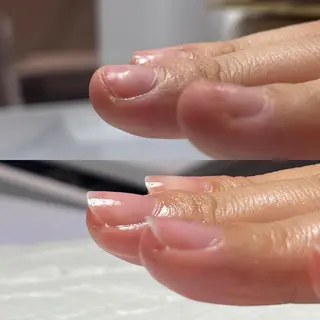ネイル 自爪育成・巻き爪 補正講師 津蔵のネイルデザイン
