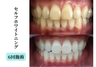 本格痩身＊透明美肌 BelleWhiteのエステ・リラクイメージ