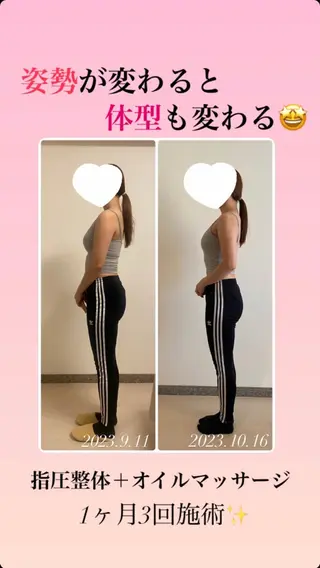 《美肌・小顔》美容鍼 &マッサージ*MEIのエステ・リラクイメージ