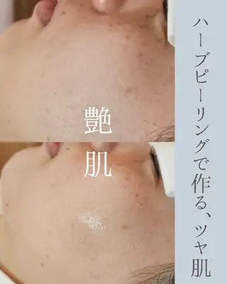 毛穴ハーブピーリング gypsophiraのエステ・リラクイメージ