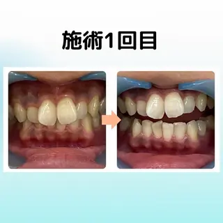 ホワイトニング シャトンのその他イメージ