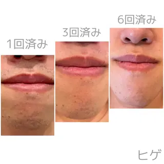 Linoa calm SANAのエステ・リラクイメージ