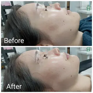 肌質改善Beauty salon Renのエステ・リラクイメージ
