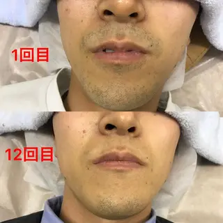 メンズ メンズ脱毛サロン /金山昌弘のエステ・リラクイメージ