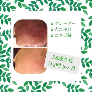 ミディアム カラー パーマ ヘアアレンジ メンズ キッズ ネイル マツエク・マツパ ニキビ・肌質改善専門 ♡人生が変わるサロンのエステ・リラクイメージ