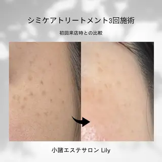 青木 彩華のエステ・リラクイメージ