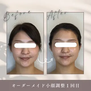 小顔セラピー LILのエステ・リラクイメージ
