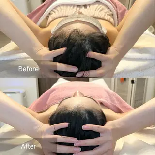 【頭痛、睡眠改善】 salon RUUのエステ・リラクイメージ