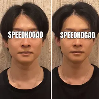 小顔矯正Speed KOGAO渋谷本店のエステ・リラクイメージ