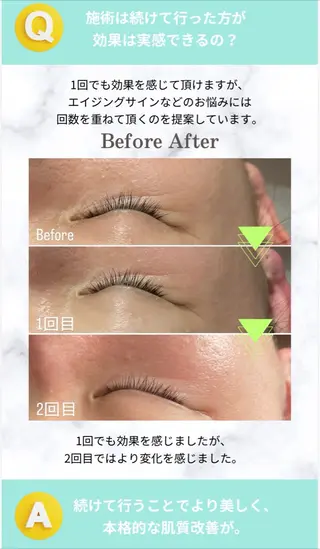 【肌育と脱毛のお店】 sharan✨✨のエステ・リラクイメージ