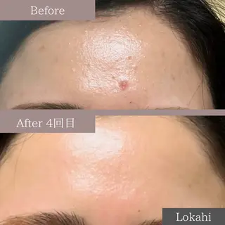 脱毛サロン Lokahiのエステ・リラクイメージ