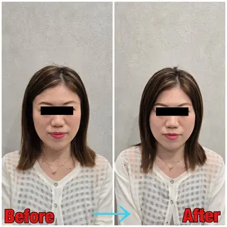 小顔矯正・美容鍼 FLOW鍼灸整体院のエステ・リラクイメージ