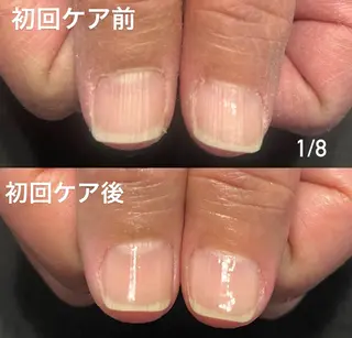 ネイル 地爪育成💅 kanaoanailのネイルデザイン
