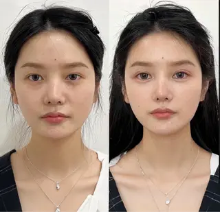マツエク・マツパ 愛維美水光美肌専門店 メンズレディースokのエステ・リラクイメージ