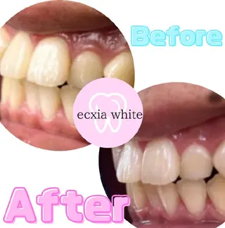 メンズ nene -ホワイトニングのその他イメージ