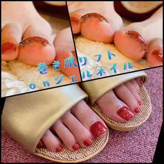 ネイル ♢ME2ROOM♢ #巻き爪#リラクのネイルデザイン
