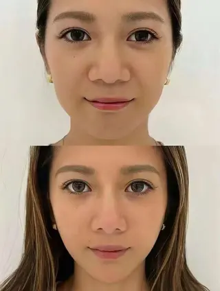 ネイル 愛維美水光専門店 川崎彩鳳のエステ・リラクイメージ