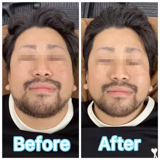 Beauty sal on Ren⭐️立谷のエステ・リラクイメージ
