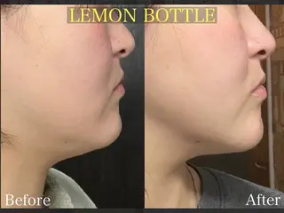 佐々木 風奈のエステ・リラクイメージ