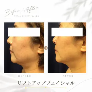 《 肌質×美肌 》 addissimoのエステ・リラクイメージ