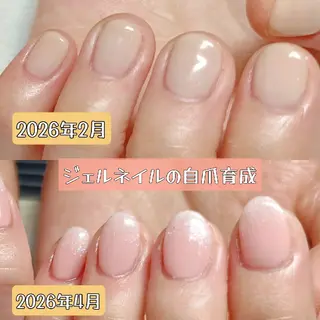 ネイル 深爪矯正/爪育成ケア manie nailのネイルデザイン
