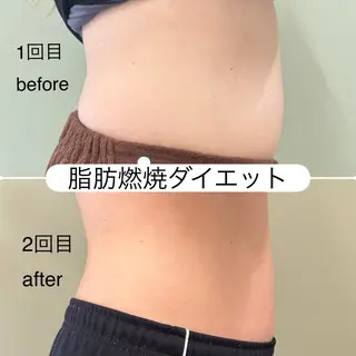 ほねつぎ一休さん 宇品店のエステ・リラクイメージ