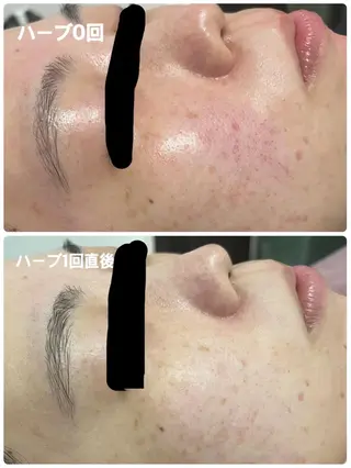 SALON BioBioのエステ・リラクイメージ