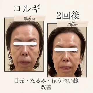 La cherieのエステ・リラクイメージ