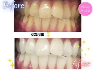 エクシア ホワイトニング西条店のその他イメージ